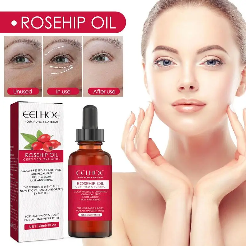 Cold Pressed Rose Hip - Óleo de semente de rosa mosqueta