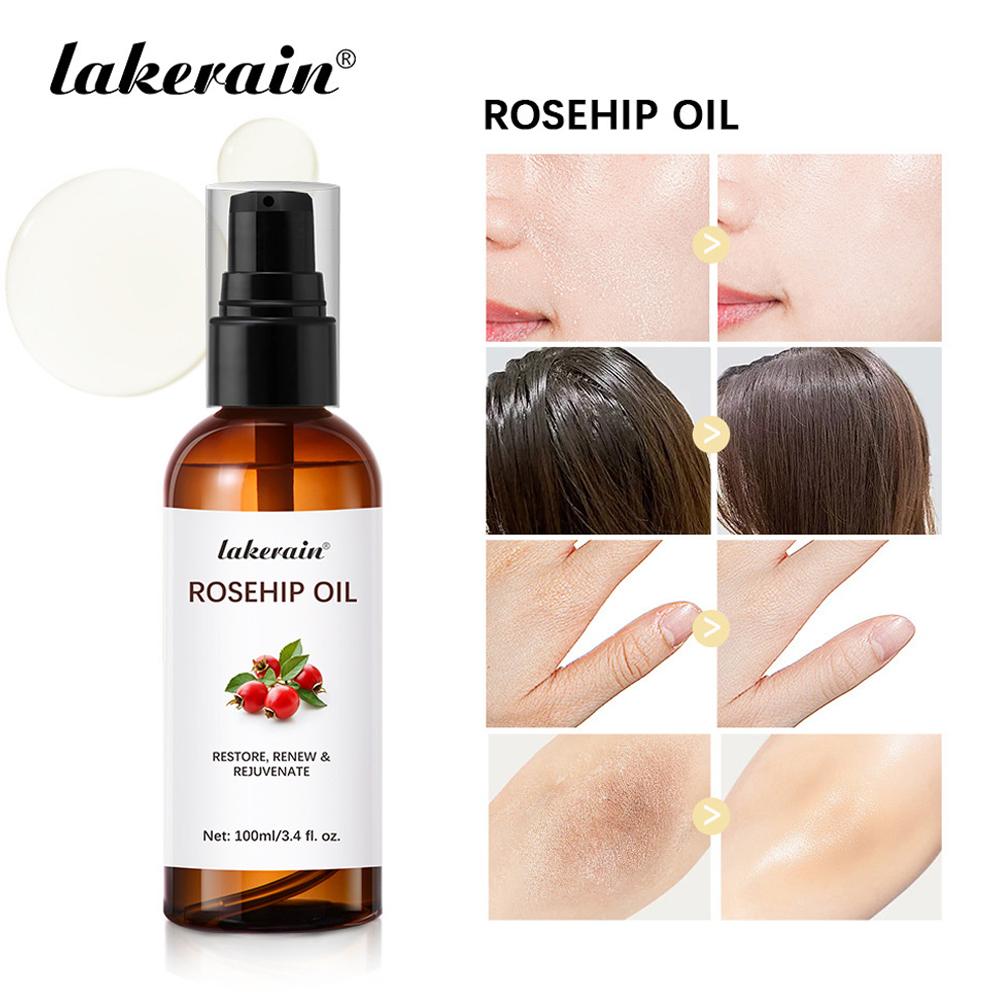 Óleo de rosa mosqueta para ros - Cold Pressed Rose Hip avaliação e preço